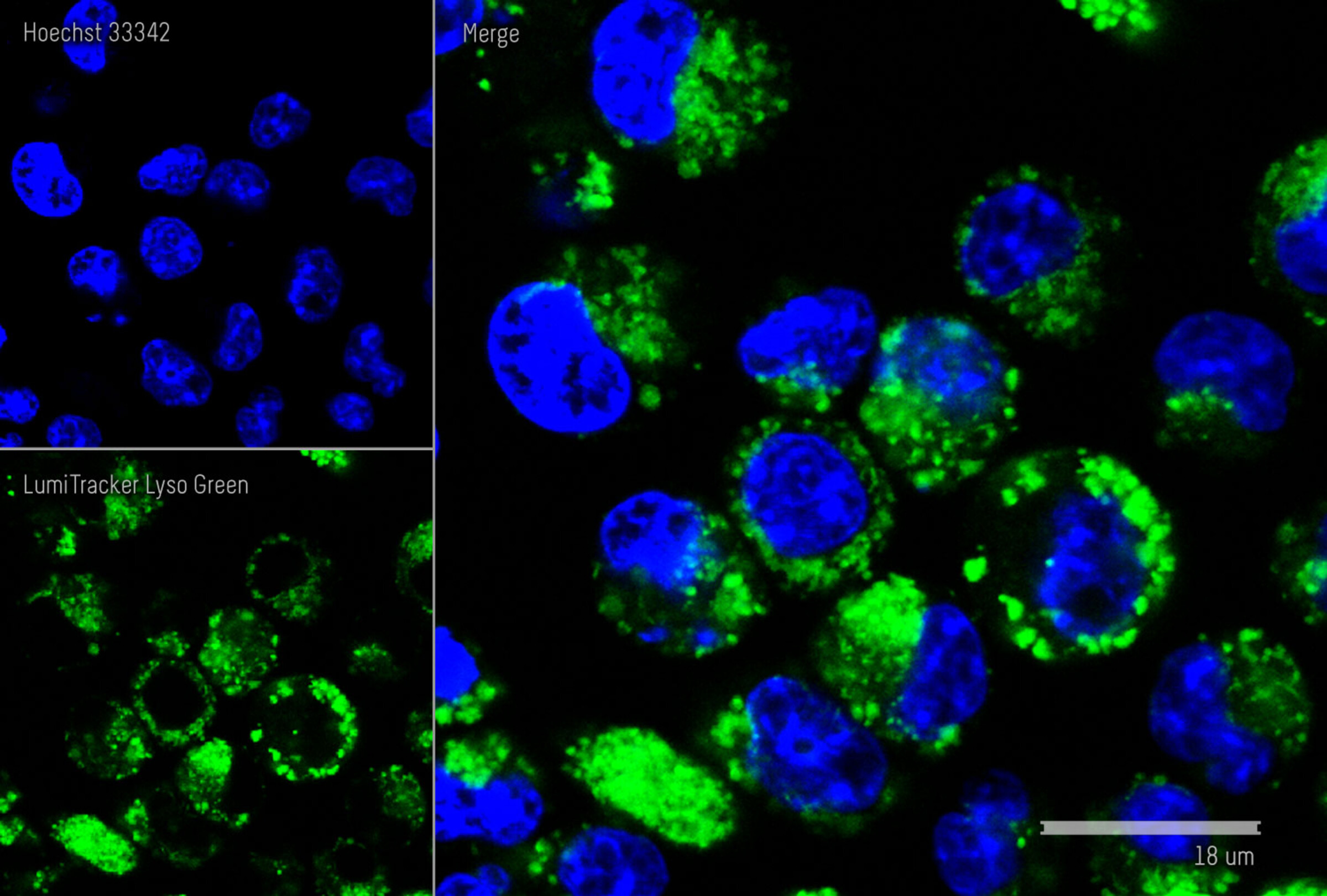 LumiTracker Lyso Green
